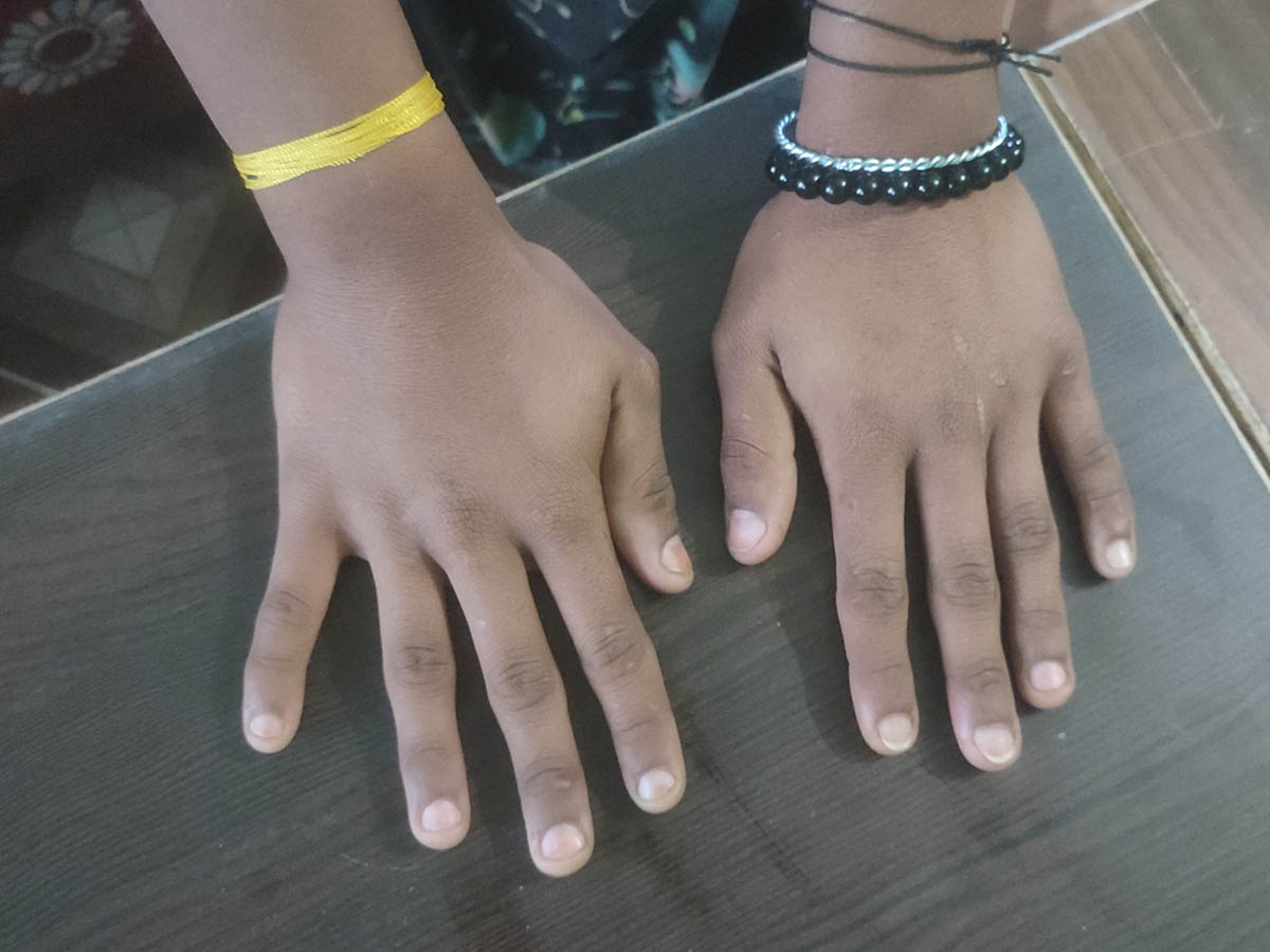 आफन्तबाटै बेचिन्छन् बालिका र किशोरी